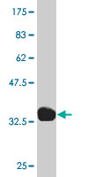 1 - SGCB Antibody (monoclonal) (M02) AT3853a