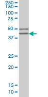 1 - SGCB Antibody (monoclonal) (M02) AT3853a