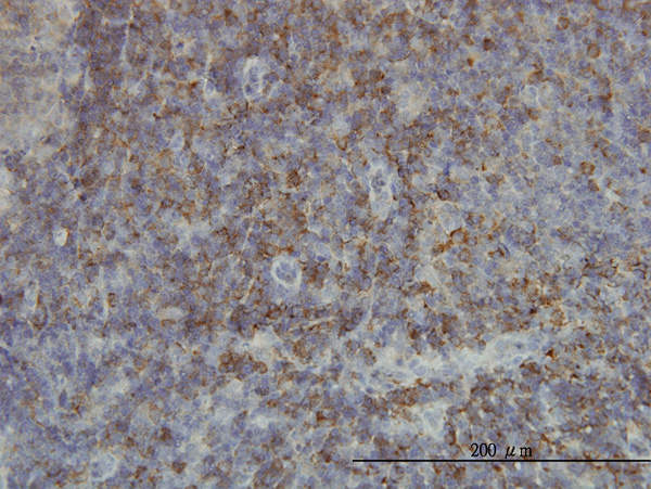 2 - SH2D3C Antibody (monoclonal) (M01) AT3863a