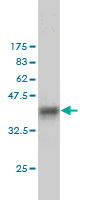 1 - SH2D3C Antibody (monoclonal) (M01) AT3863a