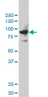 1 - SH2D3C Antibody (monoclonal) (M01) AT3863a