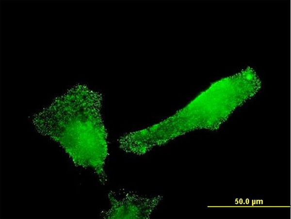 3 - SH2D3C Antibody (monoclonal) (M02) AT3864a