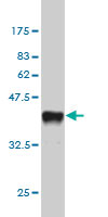 1 - SH2D3C Antibody (monoclonal) (M02) AT3864a