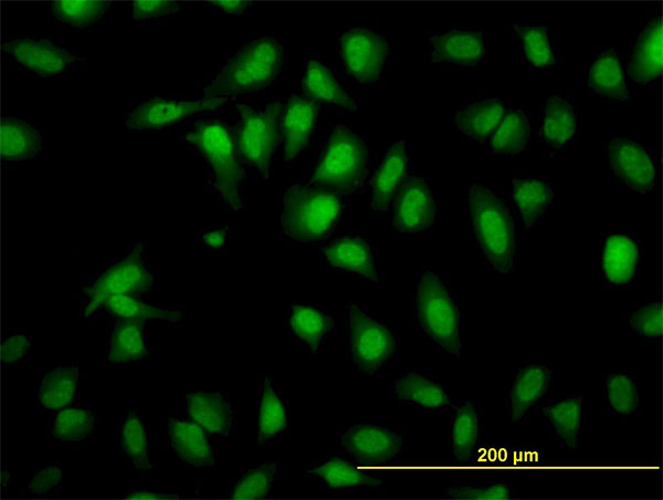 3 - SH2D4A Antibody (monoclonal) (M01) AT3865a