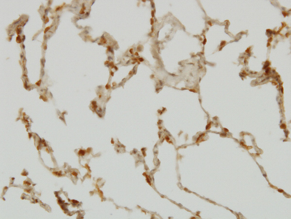 2 - SH2D4A Antibody (monoclonal) (M01) AT3865a