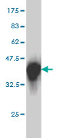 1 - SH2D4A Antibody (monoclonal) (M01) AT3865a