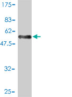 1 - SH3BGR Antibody (monoclonal) (M01) AT3866a