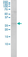 1 - SH3BGR Antibody (monoclonal) (M01) AT3866a