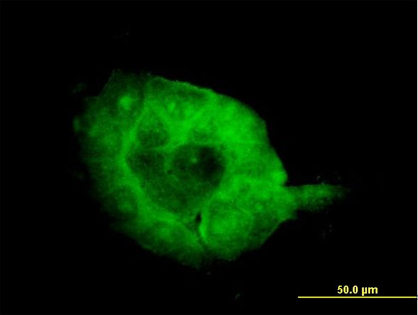3 - SH3BP2 Antibody (monoclonal) (M01) AT3868a