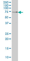 1 - SH3BP2 Antibody (monoclonal) (M01) AT3868a
