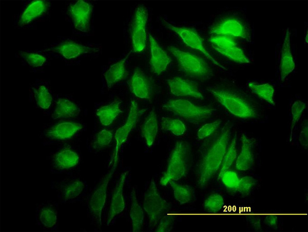 3 - SH3D19 Antibody (monoclonal) (M01) AT3872a
