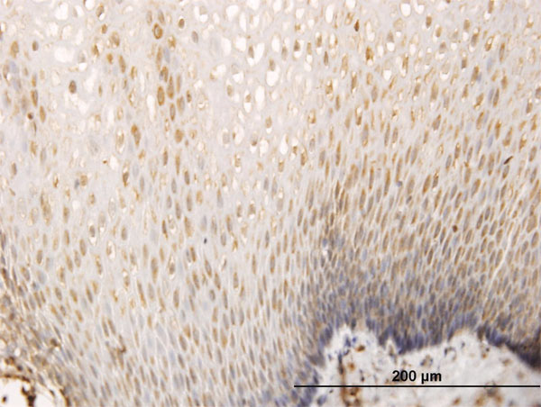 2 - SH3D19 Antibody (monoclonal) (M01) AT3872a