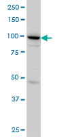 1 - SH3D19 Antibody (monoclonal) (M01) AT3872a