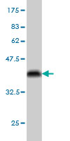 1 - SH3MD2 Antibody (monoclonal) (M01) AT3876a
