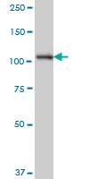 1 - SH3MD2 Antibody (monoclonal) (M01) AT3876a