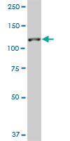 1 - SH3MD2 Antibody (monoclonal) (M01) AT3876a