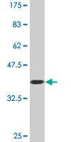 1 - SH3PX3 Antibody (monoclonal) (M03) AT3877a