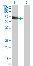 1 - SH3PX3 Antibody (monoclonal) (M03) AT3877a
