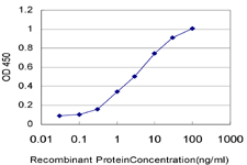 10 - SIX4 Antibody (monoclonal) (M07) AT3895a
