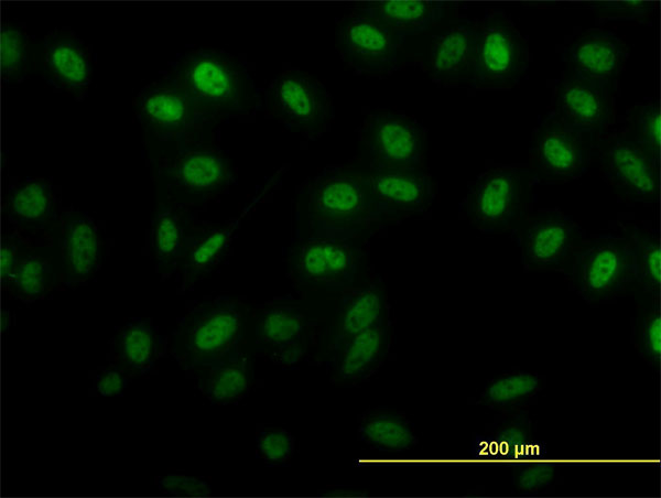 3 - SIX4 Antibody (monoclonal) (M07) AT3895a
