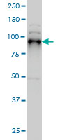 1 - SIX4 Antibody (monoclonal) (M07) AT3895a
