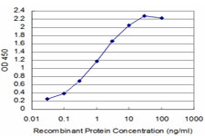 10 - SIX4 Antibody (monoclonal) (M09) AT3896a