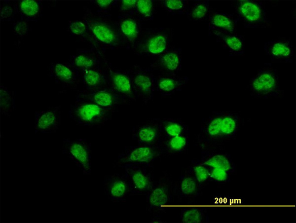 3 - SIX4 Antibody (monoclonal) (M09) AT3896a