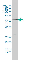 1 - SLC18A1 Antibody (monoclonal) (M01) AT3903a