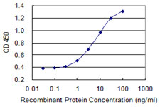 10 - SLC26A2 Antibody (monoclonal) (M04) AT3914a