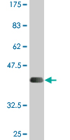 1 - SLC26A2 Antibody (monoclonal) (M04) AT3914a