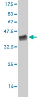 1 - SLC29A4 Antibody (monoclonal) (M03) AT3918a