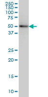 1 - SLC29A4 Antibody (monoclonal) (M03) AT3918a