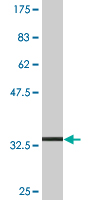 1 - SLC36A2 Antibody (monoclonal) (M04) AT3923a