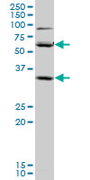 1 - SLC36A2 Antibody (monoclonal) (M04) AT3923a