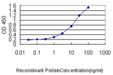 10 - SLC45A2 Antibody (monoclonal) (M02) AT3926a