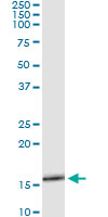 5 - SLURP1 Antibody (monoclonal) (M06) AT3935a