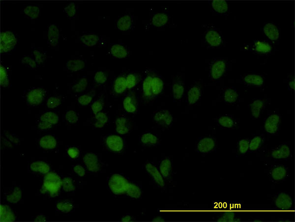 3 - SMARCD2 Antibody (monoclonal) (M01) AT3952a