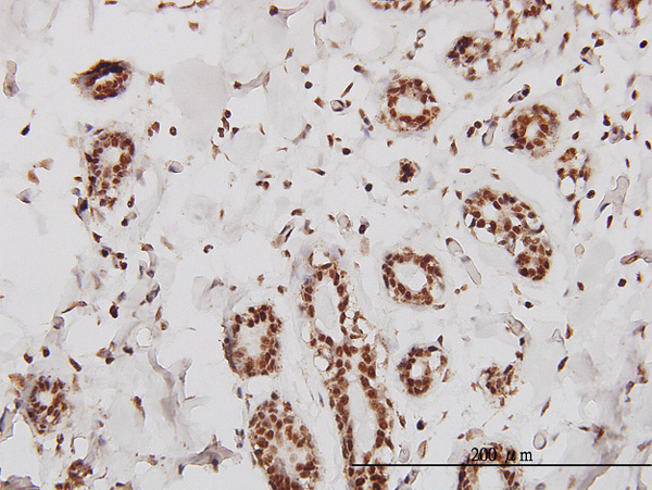 2 - SMARCD2 Antibody (monoclonal) (M01) AT3952a