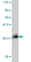 1 - SMARCD2 Antibody (monoclonal) (M01) AT3952a