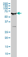 1 - SMARCD2 Antibody (monoclonal) (M01) AT3952a