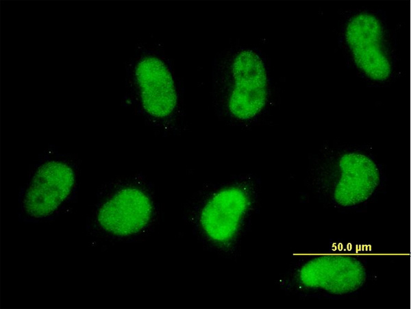 3 - SMARCD2 Antibody (monoclonal) (M02) AT3953a