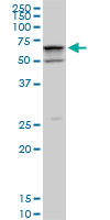 1 - SMARCD2 Antibody (monoclonal) (M02) AT3953a