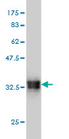 1 - SMOC1 Antibody (monoclonal) (M03) AT3961a