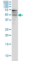 1 - SMOC1 Antibody (monoclonal) (M03) AT3961a