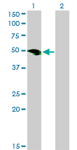 1 - SMOC1 Antibody (monoclonal) (M03) AT3961a