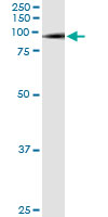 5 - SMURF1 Antibody (monoclonal) (M01) AT3966a