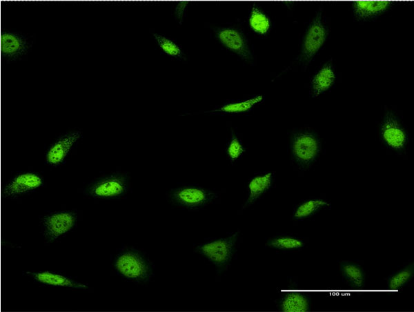 3 - SNAPC4 Antibody (monoclonal) (M01) AT3975a