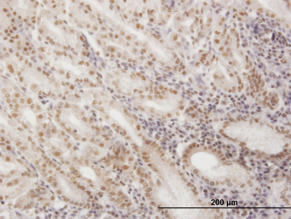 2 - SNAPC4 Antibody (monoclonal) (M01) AT3975a