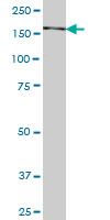1 - SNAPC4 Antibody (monoclonal) (M04) AT3976a
