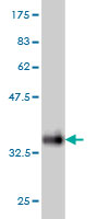 1 - SNAPC5 Antibody (monoclonal) (M07) AT3978a